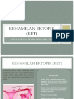 Kehamilan Ektopik (KET).pptx