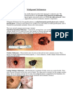 Y Malignant Melanoma