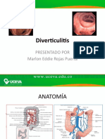 Diverticulitis Marlon Rojas