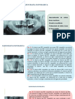 Interpretacion Radiografia Panoramica Adulto-Ya