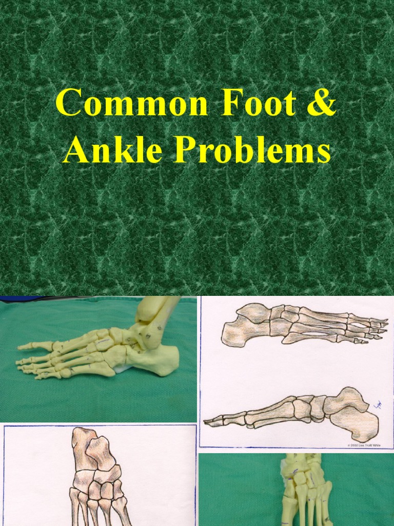 Common Foot and Ankle Problems | PDF | Toe | Foot