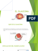 El Glaucoma