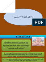 Hernia Femoralis