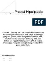 Benign Prostat Hiperplasia