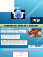 seminario trombolisis.pptx