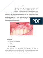 Dental Fistula