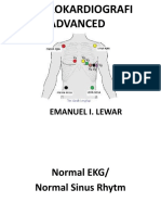 Ekg Advanced