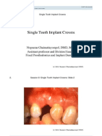 Tufts Opencourseware Session 8: Single Tooth Implant Crowns Lecture Slides