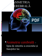 Asimetria cerebrala