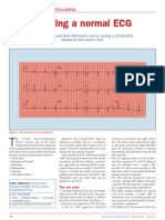 Ecg PDF