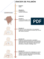 Infografico Fases Cancer Pulmon