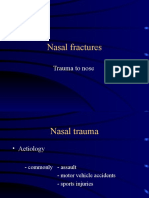 Nasal Fractures: Trauma To Nose