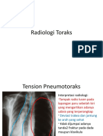 Radiologi Toraks