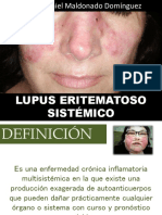 Lupus Eritematososistemico