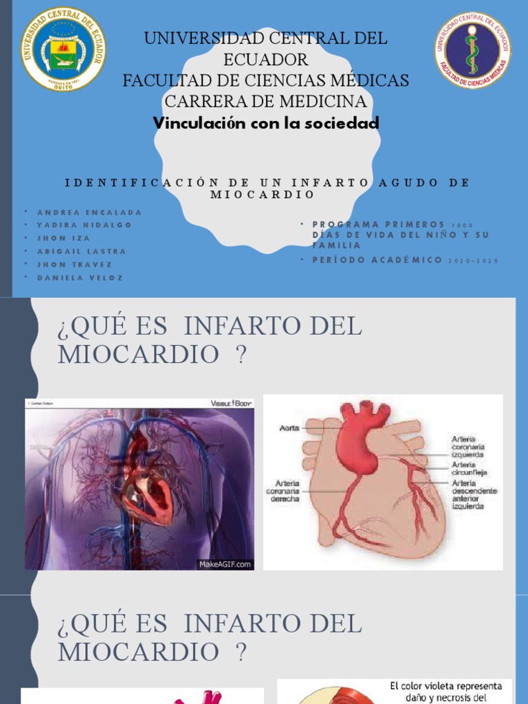 Infarto Agudo de Miocardio y Diagnóstico | PDF | Infarto de miocardio ...