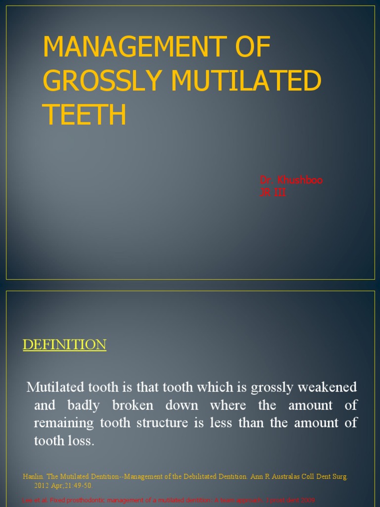 Management of Grossly Mutilated Teeth | PDF | Human Tooth | Mouth