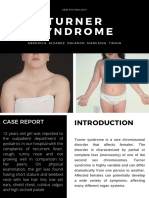 Turner Syndrome: Case Report