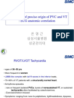 ECG-Guided Localization of RVOT and LVOT Arrhythmias