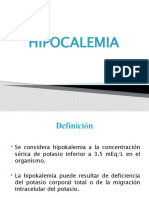 Hipocalemia