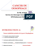 Cancer de L'oesophage