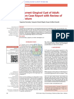 Recurrent Gingival Cyst of Adult: A Rare Case Report With Review of Literature