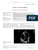 lipom cardiac.pdf