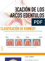 PPR Clasificacion de Kennedy PDF