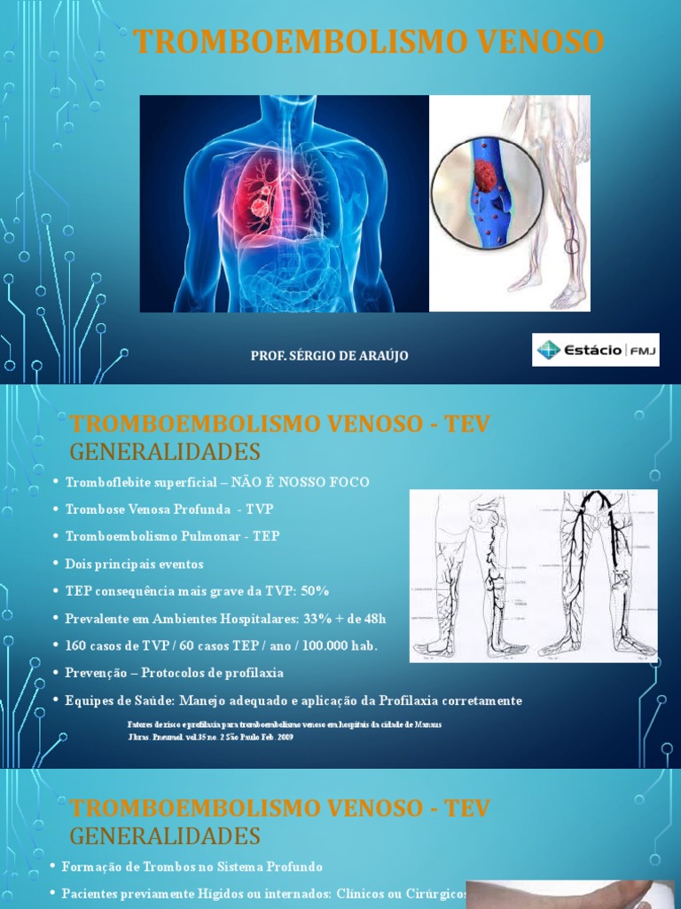 05 - Tromboembolismo Venoso | PDF | Endotélio | Epidemiologia