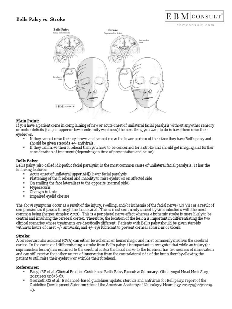 (251 KB) Bells Palsy Vs Stroke Handout PDF Stroke Human Anatomy