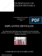 Implantes Dentales y Su