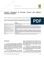 Fracture Localisation of Porcelain Veneers With Different Preparation Designs