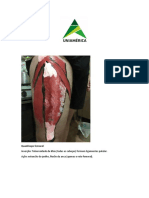 Quadr Ceps Femoral