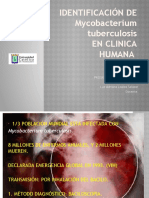 Tuberculosis