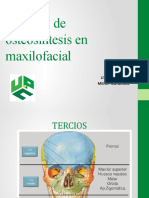 Material de Osteosíntesis en Maxilofacial
