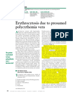 Erythrocytosis Due To Presumed Polycythemia Vera