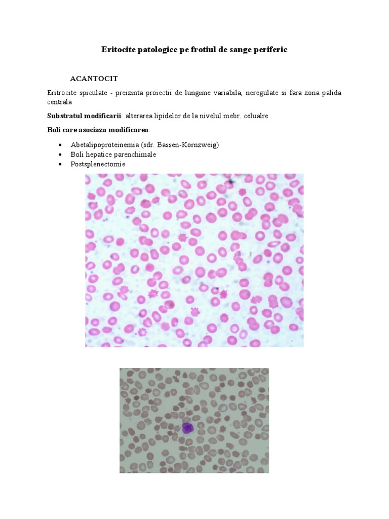 Pathologic Red Cells in Blood Smears | PDF