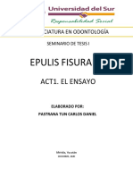 Epulis Fisurado: Act1. El Ensayo