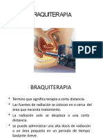 Pdf-Braquiterapia Libro Medicina