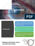 Glaucoma