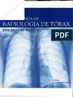 Radiografía de tórax: técnica de realización