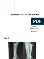 Prinicple of External Fixator