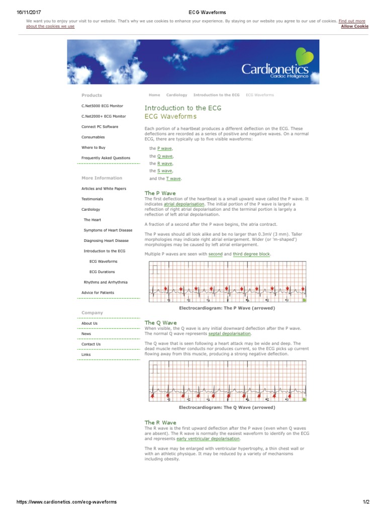 ECG Waveforms | PDF | Electrocardiography | Physiology