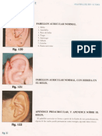 Pabellón Auricular