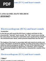 Experiment 6:: Electrocardiogram (ECG) and Heart Sounds