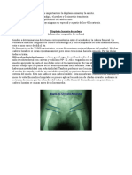 afecciones ortopedicas de cadera.doc