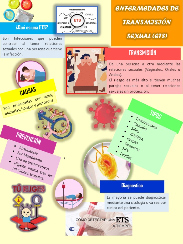 Poster Ets | PDF