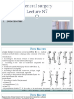 General Surgery Lecture N: 1. Bone Fracture