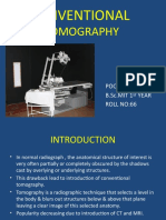 Conventional Tomography