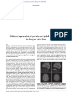 Bilateral Symmetrical Parieto Occipital Involvement in Dengue Infection