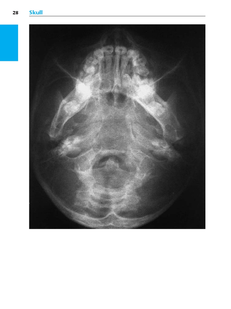 Pocket Atlas of Radiographic Anatomy 41-50 | PDF | Skull | Human Head ...